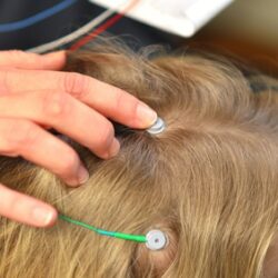 Neurofeedback Bioofeedback